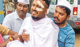 രക്ഷപ്പെട്ടിട്ടും മനഃസമാധാനമില്ല, മ​​​​​​നഃ​​​ശാ​​​​​​സ്ത്ര​​​​​​ജ്ഞ​​​​​​ന്‍റെ സ​​​​​​ഹാ​​​​​​യം​​​ തേ​​​​​​ടി വി​​​​​​ശ്വാ​​​​​​സ് കു​​​​​​മാ​​​​​​ർ ര​​​​​​മേ​​​​​​ശ്